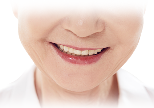 고령 임플란트